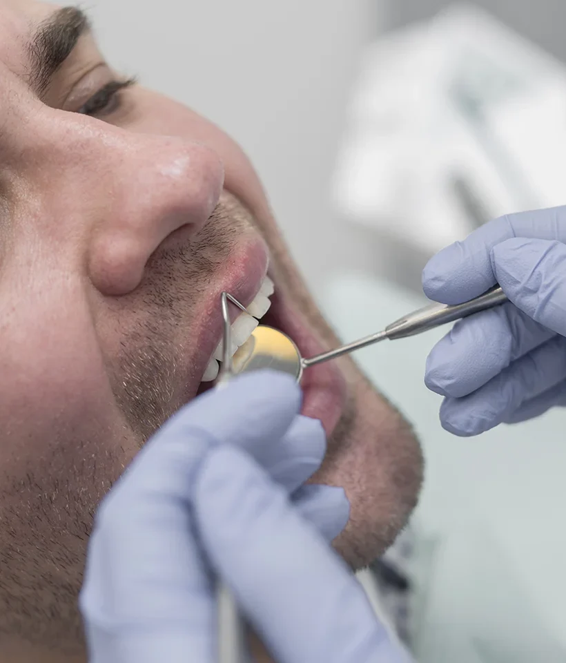 Bone Grafting