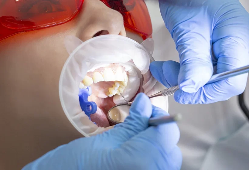 Bone Grafting