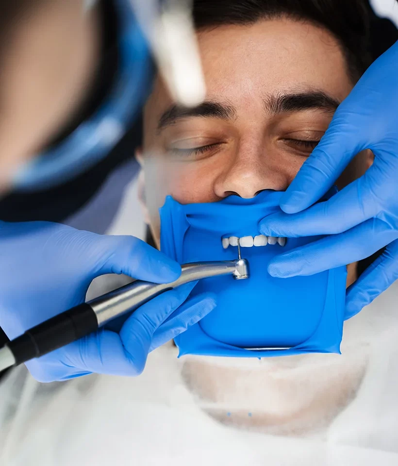 Dental Bonding