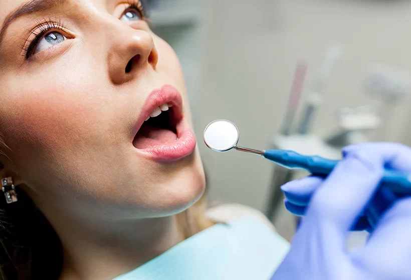 Dental Bridges