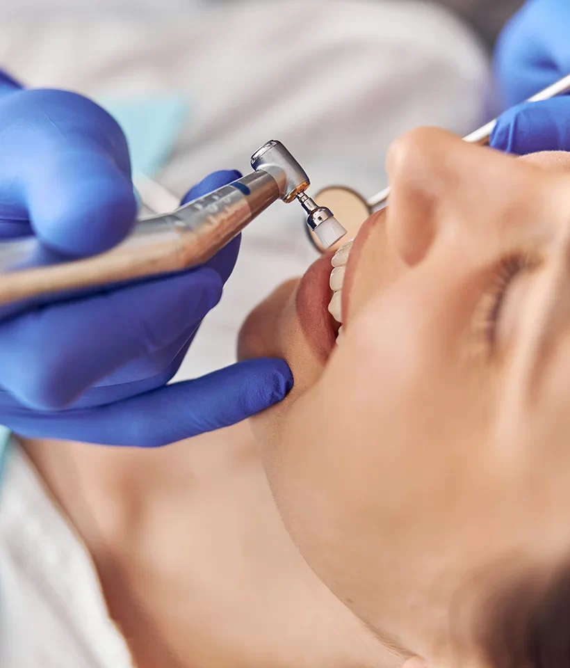 Dental Cleanings