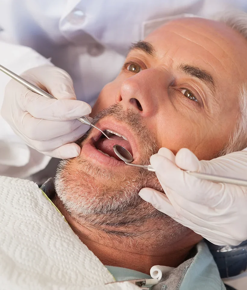Dental Crowns