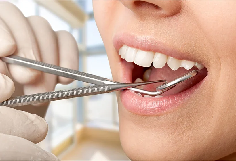 Dental Crowns