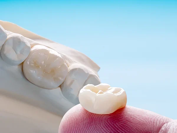 Porcelain or Ceramic Crowns