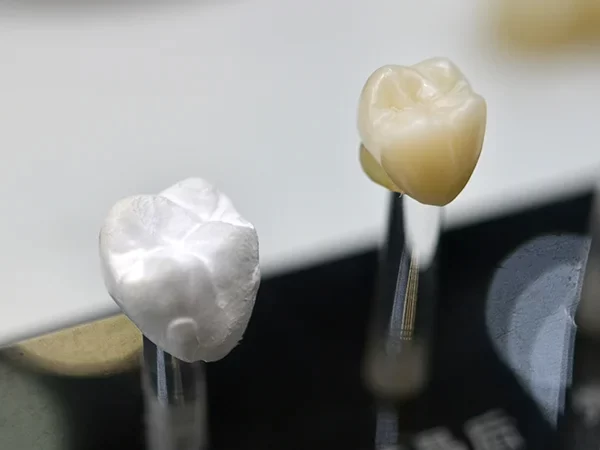 Zirconia Crowns