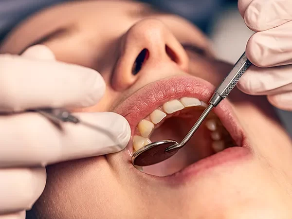 Simple Extractions