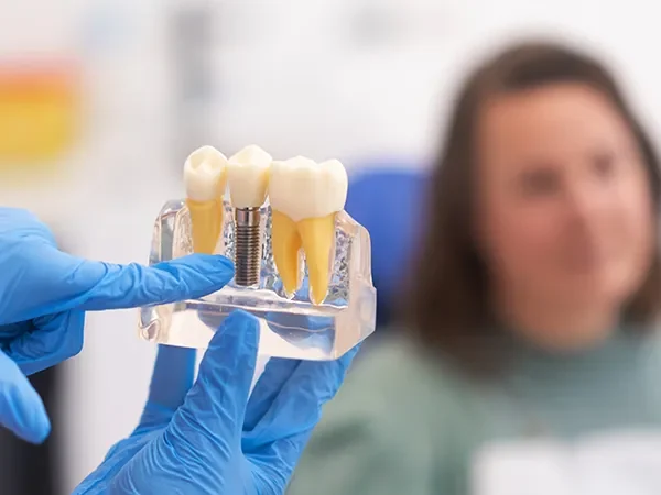 Single-Tooth Implants