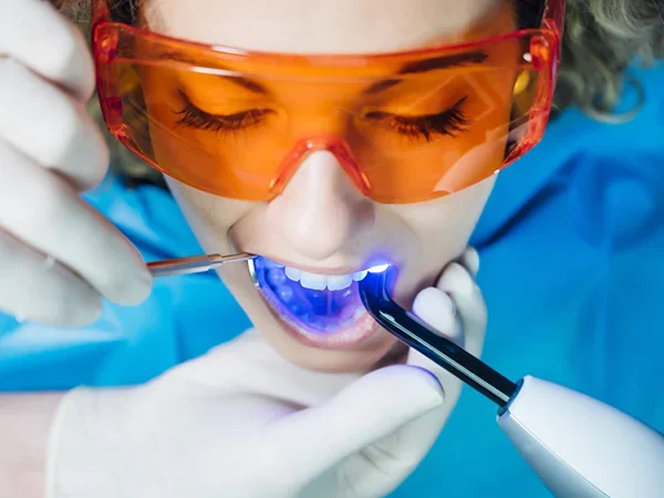 Resin-Based Sealants