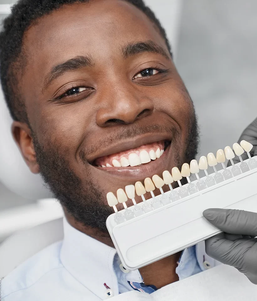 Dental Veneers