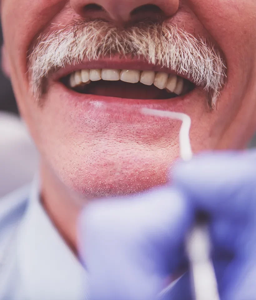 Dentures