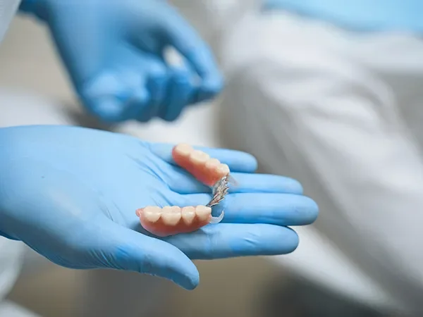 Partial Dentures