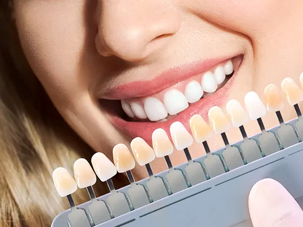 Cosmetic Smile Planning