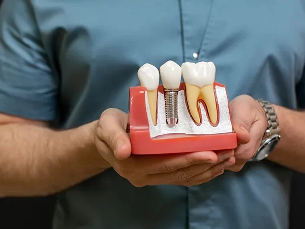 Restorative and Implant Design