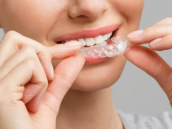 Orthodontic and Invisalign Integration