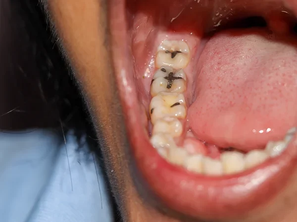 Restorative Dentistry