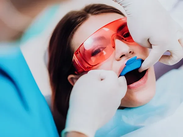 Fluoride Treatments