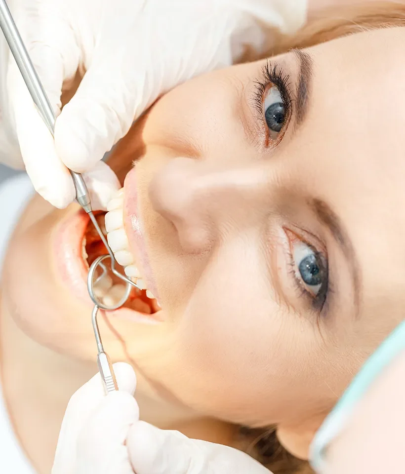 Fluoride Treatments