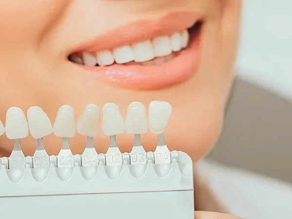 Traditional Dental Crowns