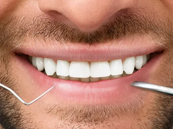 Same-Day Crowns with Glidewell Mills Technology