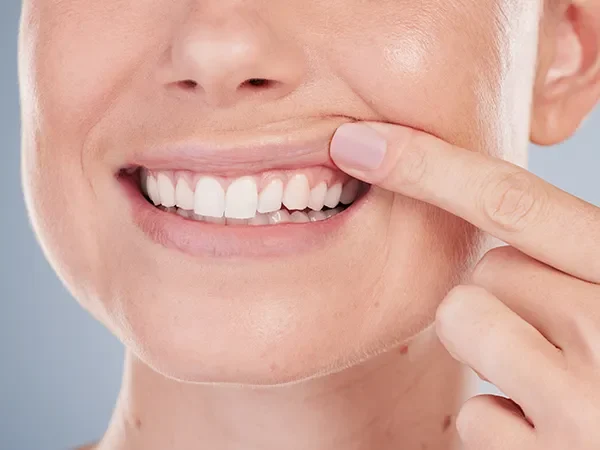 Gum Disease Treatment