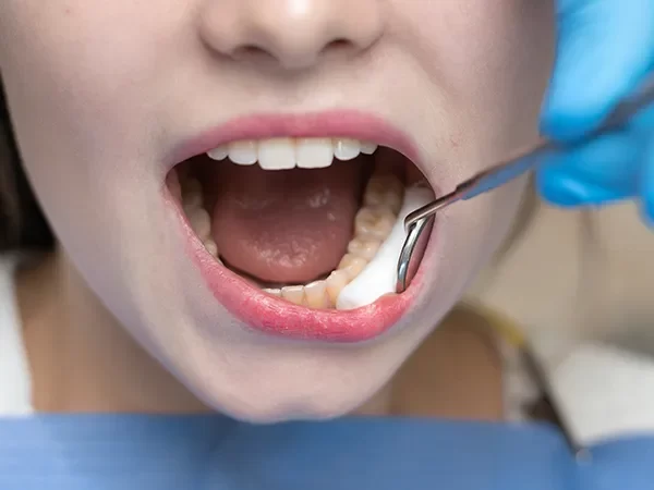 Gum Surgery