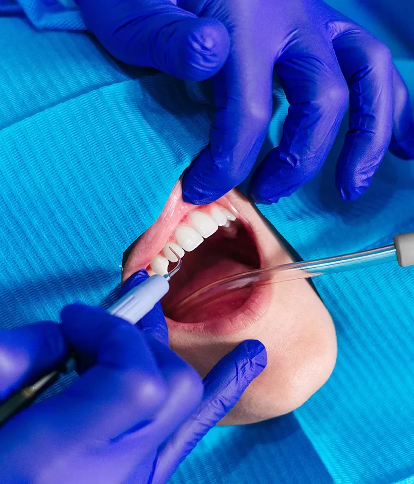 Gum Surgery
