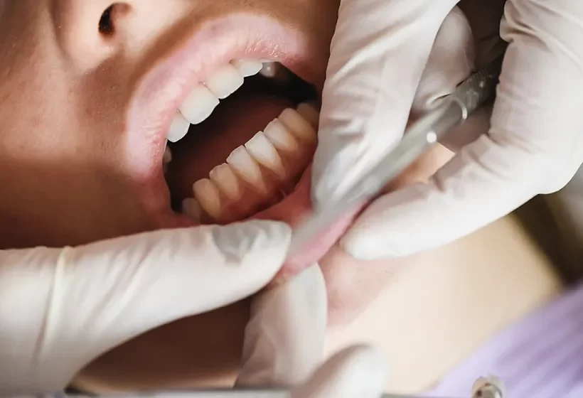 Gum Surgery
