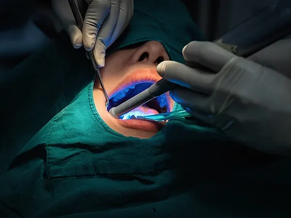 Regenerative Periodontal Procedures (When Needed)