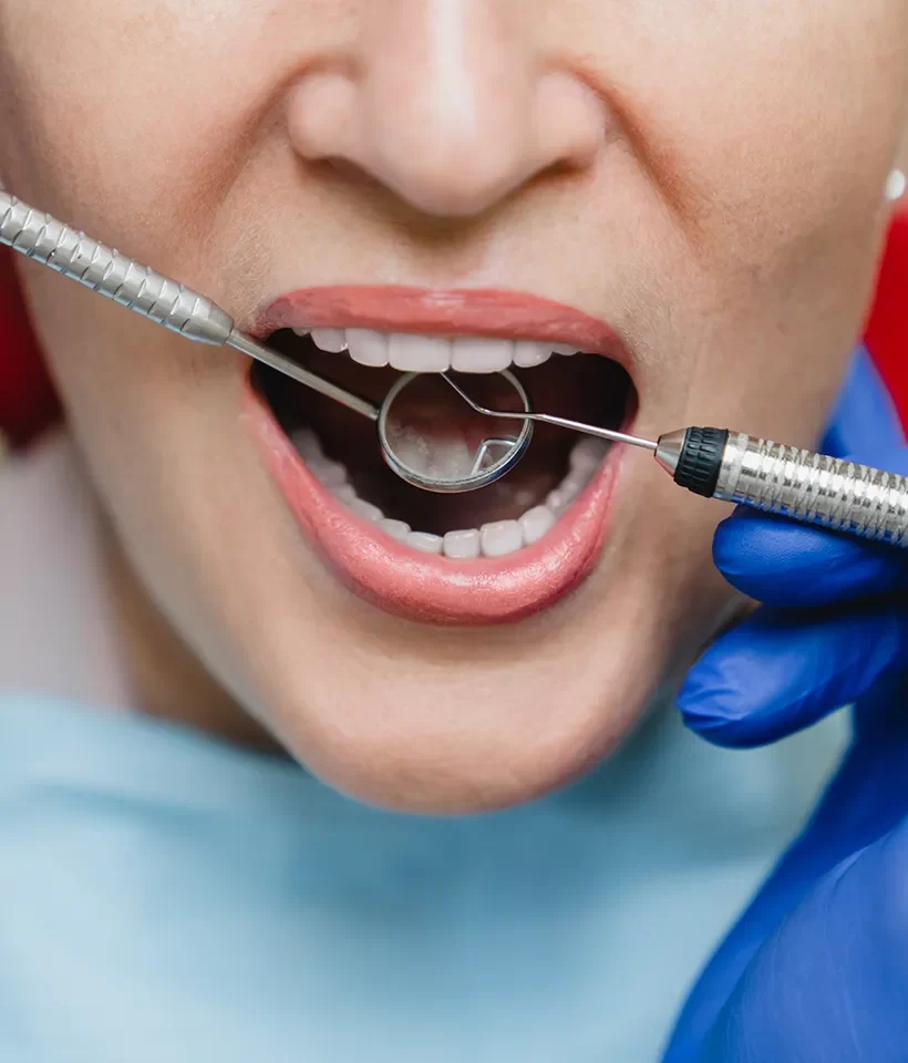 Implant-Supported Dentures