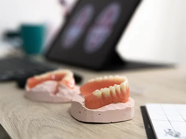 Removable Implant-Supported Dentures