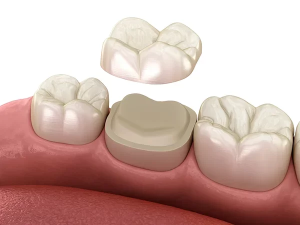 Advanced Ceramic or Hybrid Materials