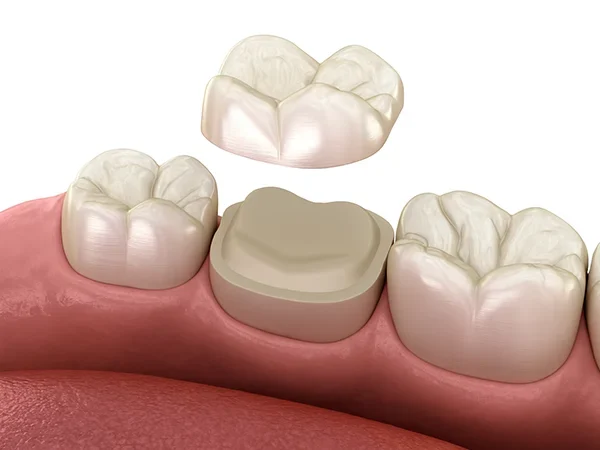 Advanced Ceramic or Hybrid Materials