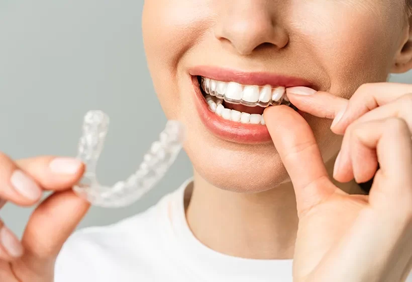 Invisalign