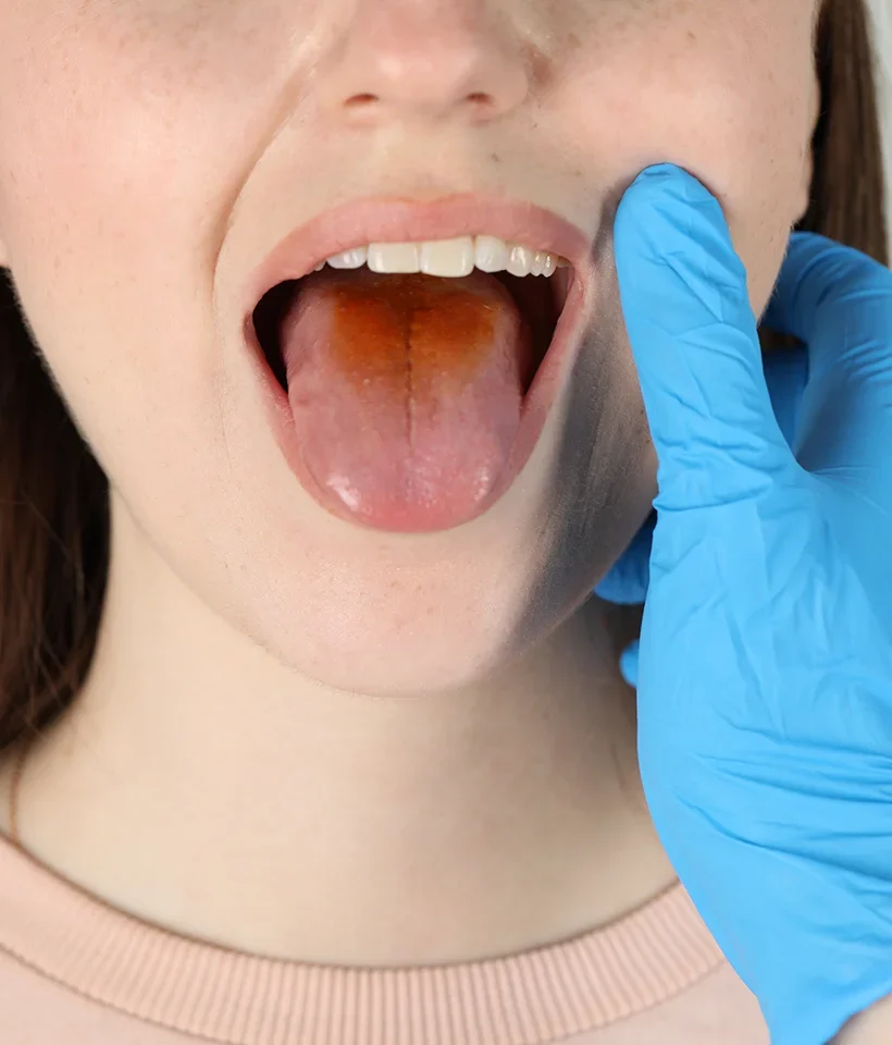 Oral Cancer Screening