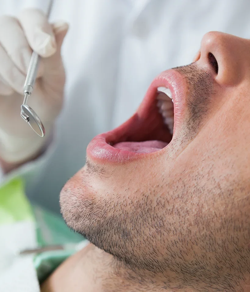 Oral Cancer Screening