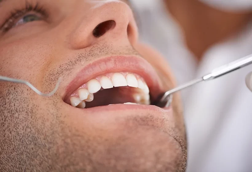 Oral Cancer Screening