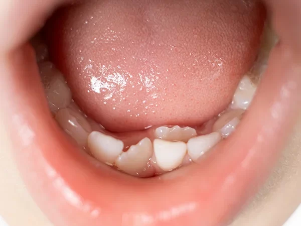 Developmental and Orthodontic Monitoring