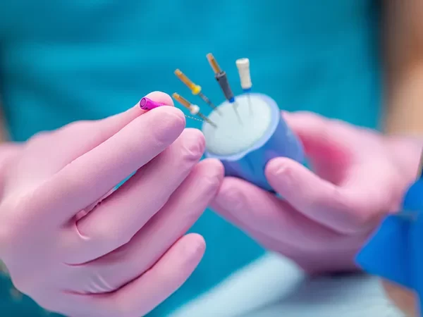 Anterior Root Canal Therapy