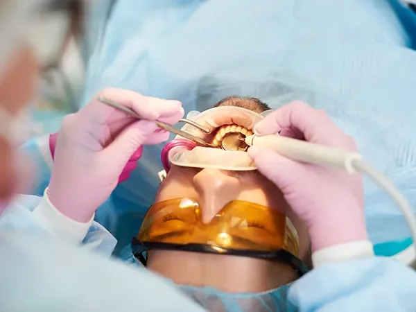 Molar Root Canal Therapy