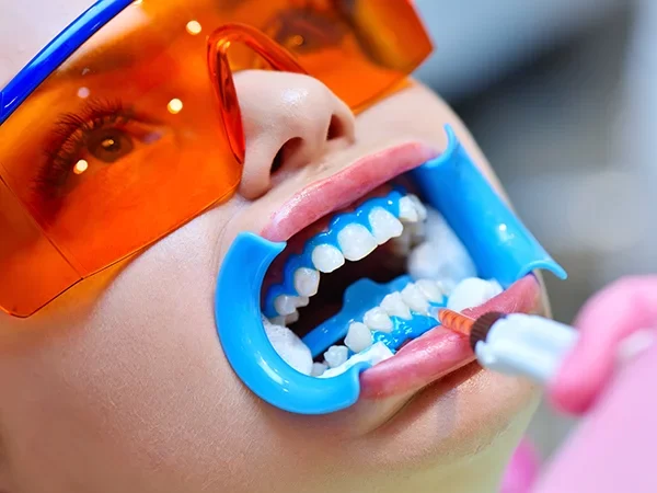Cosmetic Contouring & Whitening