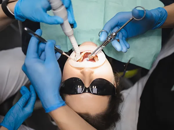 Simple Wisdom Teeth Extractions